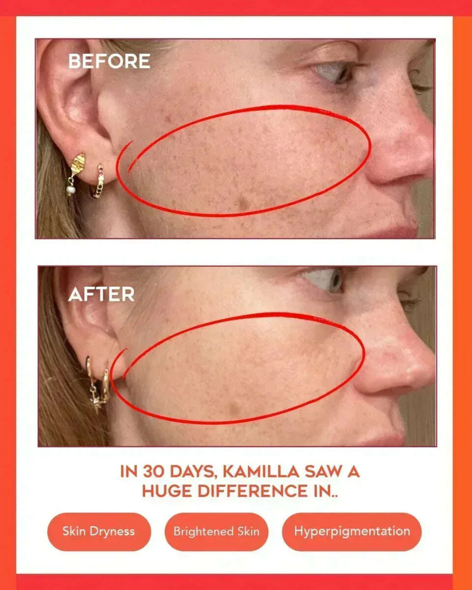 Clear Confidence Moisturizer - Refillable - Image 9