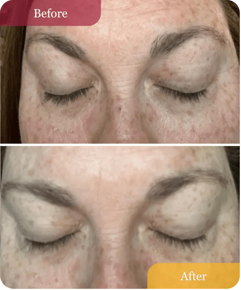 Hydrating Dew Moisturizer - Refillable - Image 9